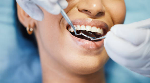 Best Broken or Chipped Tooth Repair in Bowie, TX