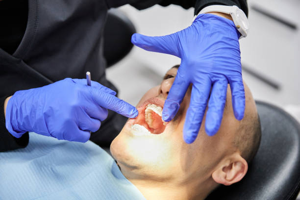 Best Emergency Dental Care for Sports Injuries in Bowie, TX